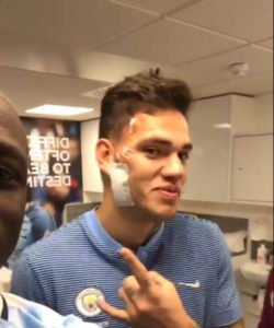 Luka Wajah Kiper Manchester City Ederson Tidaklah Parah